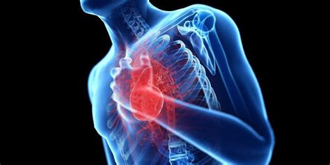 Penyakit Jantung Koroner: Memahami dan Mencegahnya